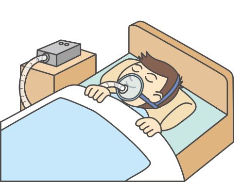 CPAPの装着方法について、医師が詳しく解説します。